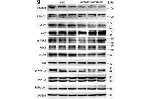 PSMD1 and PSMD2 regulate the expression level of fatty acids (FAs) and lipid synthesis-related genes. (MAPK14 抗体  (pThr180, pTyr182))