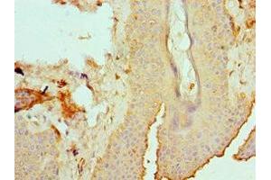 Immunohistochemistry of paraffin-embedded human skin tissue using ABIN7151878 at dilution of 1:100 (Ephrin B2 抗体  (AA 28-229))