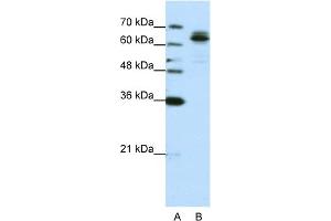 WB Suggested Anti-FXR1 Antibody Titration:  0. (FXR1 抗体  (C-Term))