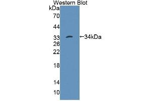 Western blot analysis of the recombinant protein. (PTPN22 抗体  (AA 1-256))