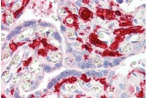 Human Placenta (formalin-fixed, paraffin-embedded) stained with F13A1 antibody ABIN461970 at 5 ug/ml followed by biotinylated secondary antibody, alkaline phosphatase-streptavidin and chromogen. (F13A1 抗体)