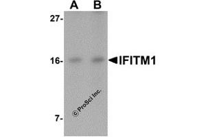 Western Blotting (WB) image for anti-Interferon-Induced Transmembrane Protein 1 (IFITM1) (C-Term) antibody (ABIN1030430)