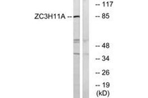 Western blot analysis of extracts from COS cells, using ZC3H11A Antibody.