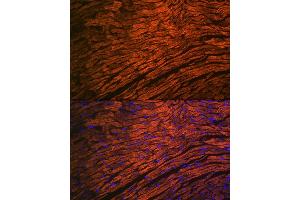 Immunofluorescence analysis of mouse heart using MYL2 Rabbit mAb (ABIN7268761) at dilution of 1:100 (40x lens). (MYL2 抗体)