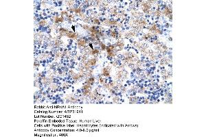 Rabbit Anti-NR4A1 Antibody  Paraffin Embedded Tissue: Human Liver Cellular Data: Hepatocytes Antibody Concentration: 4. (NR4A1 抗体  (N-Term))
