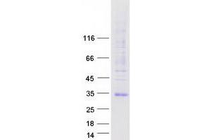 Western Blotting (WB) image for Aquaporin 7 (AQP7) protein (Myc-DYKDDDDK Tag) (ABIN2714853)