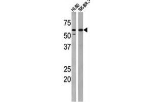 Western Blotting (WB) image for anti-Myelin Transcription Factor 1 (MYT1) (pThr495) antibody (ABIN3001766) (MYT1 抗体  (pThr495))