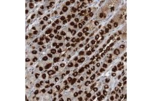 Immunohistochemical staining of human stomach with GIN1 polyclonal antibody  shows strong cytoplasmic positivity in parietal cells at 1:20-1:50 dilution. (GIN1 抗体)