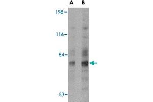 Western blot analysis of SNPH in human brain tissue lysate with SNPH polyclonal antibody  at (A) 2 and (B) 4 ug/mL . (Syntaphilin 抗体  (N-Term))