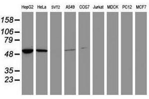 Image no. 1 for anti-Epoxide Hydrolase 1, Microsomal (Xenobiotic) (EPHX1) (AA 21-230) antibody (ABIN1491196) (EPHX1 抗体  (AA 21-230))