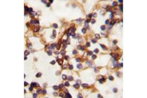 Immunohistochemistry (IHC) image for anti-RPTOR Independent Companion of mTOR, Complex 2 (RICTOR) (AA 252-281) antibody (ABIN3028991)