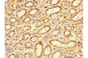 Immunohistochemistry of paraffin-embedded human renal tissue using ABIN7165680 at dilution of 1:100 (PKC alpha 抗体  (AA 495-659))
