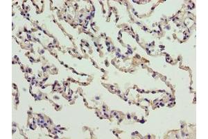 Immunohistochemistry of paraffin-embedded human lung tissue using ABIN7165213 at dilution of 1:100 (CNIH3 抗体  (AA 94-138))