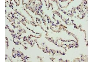 Immunohistochemistry of paraffin-embedded human lung tissue using ABIN7165213 at dilution of 1:100