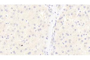 Detection of LRP6 in Human Liver Tissue using Monoclonal Antibody to Low Density Lipoprotein Receptor Related Protein 6 (LRP6) (LRP6 抗体  (AA 981-1213))