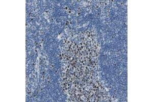 Immunohistochemical staining (Formalin-fixed paraffin-embedded sections) of human lymph node with MCM3 polyclonal antibody  shows strong nuclear positivity in reaction center cells. (MCM3 抗体)