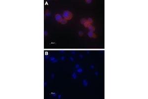 Expression of TRPV5 in PC3 cells - Immunocytochemical staining of paraformaldehyde-fixed PC-3 cells with Anti-TRPV5 Antibody (ABIN7043855, ABIN7043996 and ABIN7043997), (1:100), followed by goat anti-rabbit-AlexaFluor-555 secondary antibody (A). (TRPV5 抗体  (C-Term, Intracellular))