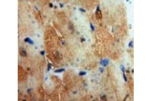 IHC-P analysis of Heart tissue, with DAB staining. (Cardiac Troponin T2 抗体  (AA 1-295))