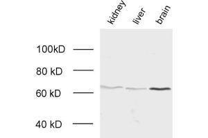 dilution: 1 : 2000, samples: whole tissue homogenate of kindey, liver and brain
