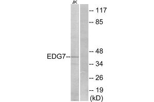 Western Blotting (WB) image for anti-Lysophosphatidic Acid Receptor 3 (LPAR3) (Internal Region) antibody (ABIN6301168) (LPAR3 抗体  (Internal Region))