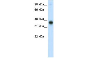 WB Suggested Anti-E2F3 Antibody Titration:  0. (E2F3 抗体  (C-Term))