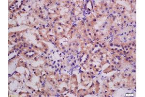 Formalin-fixed and paraffin embedded rat kidney labeled with Rabbit Anti-ATG3 Polyclonal Antibody, Unconjugated (ABIN752533) at 1:200 followed by conjugation to the secondary antibody and DAB staining (ATG3 抗体  (AA 51-150))
