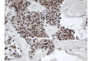 Immunohistochemistry (IHC) image for anti-alpha-1,4-N-Acetylglucosaminyltransferase (A4GNT) (AA 121-340) antibody (ABIN1490880) (A4GNT 抗体  (AA 121-340))