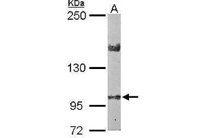 WB Image Sample (50 ug of whole cell lysate) A: Mouse brain 5% SDS PAGE antibody diluted at 1:2000 (LIMCH1 抗体  (C-Term))