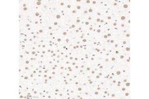 Immunohistochemistry analysis of paraffin-embedded mouse liver using,PQBP1 (ABIN7075126) at dilution of 1: 6000 (PQBP1 抗体)