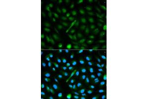 Immunofluorescence analysis of MCF-7 cells using AHSG antibody. (Fetuin A 抗体  (AA 19-300))