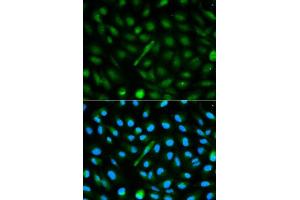 Immunofluorescence analysis of MCF-7 cells using AHSG antibody. (Fetuin A 抗体  (AA 19-300))