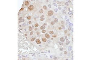 Immunohistochemistry (IHC) image for anti-Phosphate Cytidylyltransferase 1, Choline, alpha (PCYT1A) (AA 317-367) antibody (ABIN7453442) (PCYT1A 抗体  (AA 317-367))