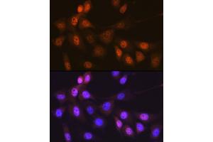 Immunofluorescence analysis of NIH-3T3 cells using Musashi-1 (MSI1) Rabbit mAb (ABIN7268700) at dilution of 1:100 (40x lens). (MSI1 抗体)