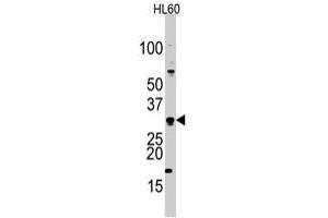Western blot analysis of CDCA8 polyclonal antibody  in HL-60 cell line lysates (35 ug/lane). (CDCA8 抗体  (Internal Region))
