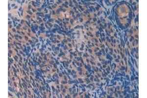 Detection of PON2 in Mouse Ovary Tissue using Polyclonal Antibody to Paraoxonase 2 (PON2) (PON2 抗体  (AA 4-289))
