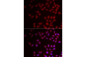Immunofluorescence analysis of HeLa cell using CIRBP antibody. (CIRBP 抗体)