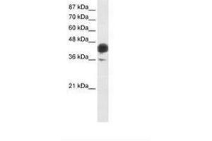 Image no. 1 for anti-Jun B Proto-Oncogene (JUNB) (AA 271-320) antibody (ABIN6736224) (JunB 抗体  (AA 271-320))