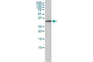 AKR7A2 monoclonal antibody (M01), clone 2A6 Western Blot analysis of AKR7A2 expression in HL-60 . (AKR7A2 抗体  (AA 1-330))