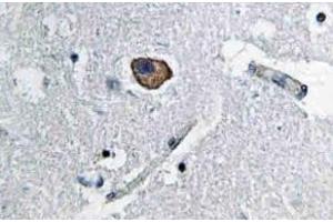 Immunohistochemistry analysis of CD171 / L1CAM Antibody in paraffin-embedded human brain tissue. (L1CAM 抗体)