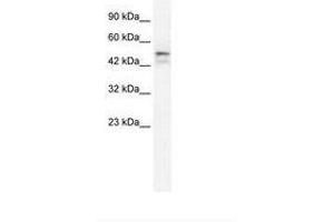 Image no. 2 for anti-One Cut Homeobox 2 (ONECUT2) (AA 293-342) antibody (ABIN202641) (ONECUT2 抗体  (AA 293-342))