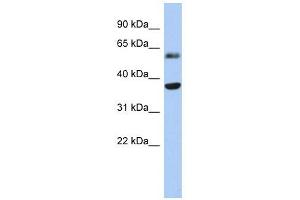 RDH10 antibody used at 1 ug/ml to detect target protein. (RDH10 抗体)