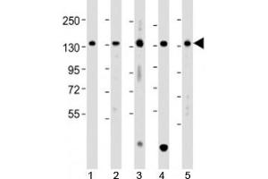 Western blot testing of human 1) A431, 2) HCT116, 3) Jurkat, 4) K562 and 5) U-2OS cell lysate with TACC3 antibody at 1:2000.