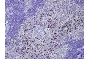 Immunohistochemistry (IHC) image for Rabbit anti-Human IgG (AA 167-185), (Internal Region) antibody (ABIN7598781) (兔 anti-人 IgG (AA 167-185), (Internal Region) Antibody)