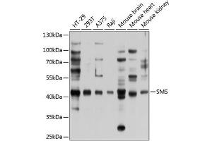 Western blot analysis of extracts of various cell lines, using SMS antibody (ABIN6133461, ABIN6148152, ABIN6148153 and ABIN6224911) at 1:1000 dilution. (SMS 抗体  (AA 1-366))