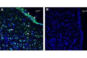 Expression of SLC38A2 in rat hypothalamus.