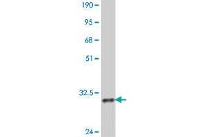 Western Blot detection against Immunogen (32. (PBX4 抗体  (AA 319-374))