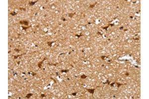 The image on the left is immunohistochemistry of paraffin-embedded Human brain tissue using ABIN7131195(SSBP4 Antibody) at dilution 1/25, on the right is treated with fusion protein. (SSBP4 抗体)