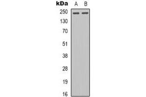 Western blot analysis of Tenascin C expression in U87MG (A), KB (B) whole cell lysates. (TNC 抗体  (C-Term))