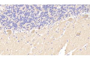 Immunohistochemistry (IHC) image for anti-Spectrin alpha Chain, Brain (SPTAN1) (AA 1573-1742) antibody (ABIN7438457)
