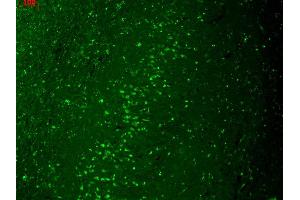 Immunohistochemistry (IHC) image for anti-Potassium Inwardly-Rectifying Channel, Subfamily J, Member 2 (KCNJ2) (AA 41-64) antibody (FITC) (ABIN2483540)